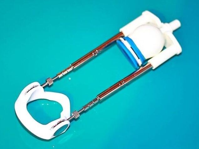 Ֆալուսը երկարացնելու համար կարող եք օգտագործել հատուկ սարք՝ երկարացնող